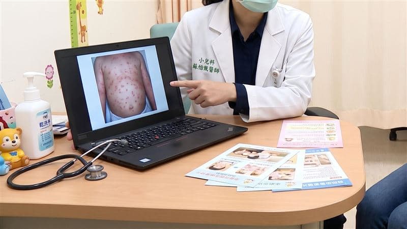 畫面曝！男童染腸病毒竟「零發燒」