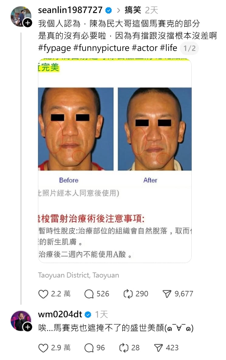 一張醫美照片近日在社群瘋傳，許多人都猜到當事人身分，陳為民本尊也親自回應了。 （翻攝自Threads）