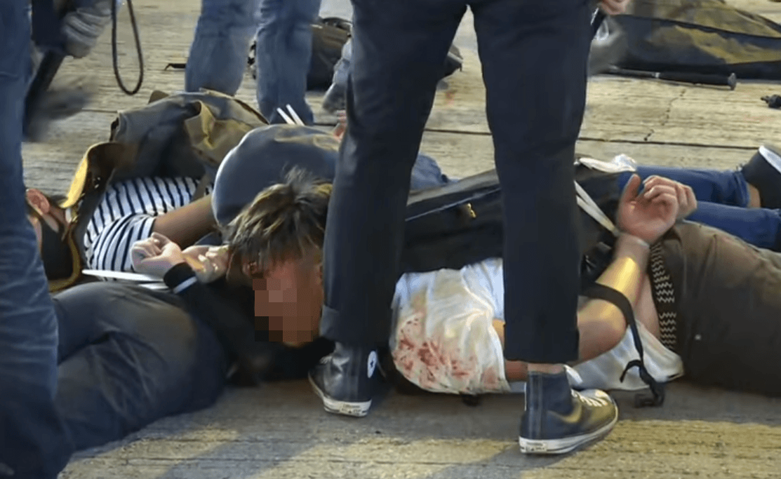 示威者遭港警和黑衣人爆力壓制，導致不少人因此受傷。（翻攝臉書）