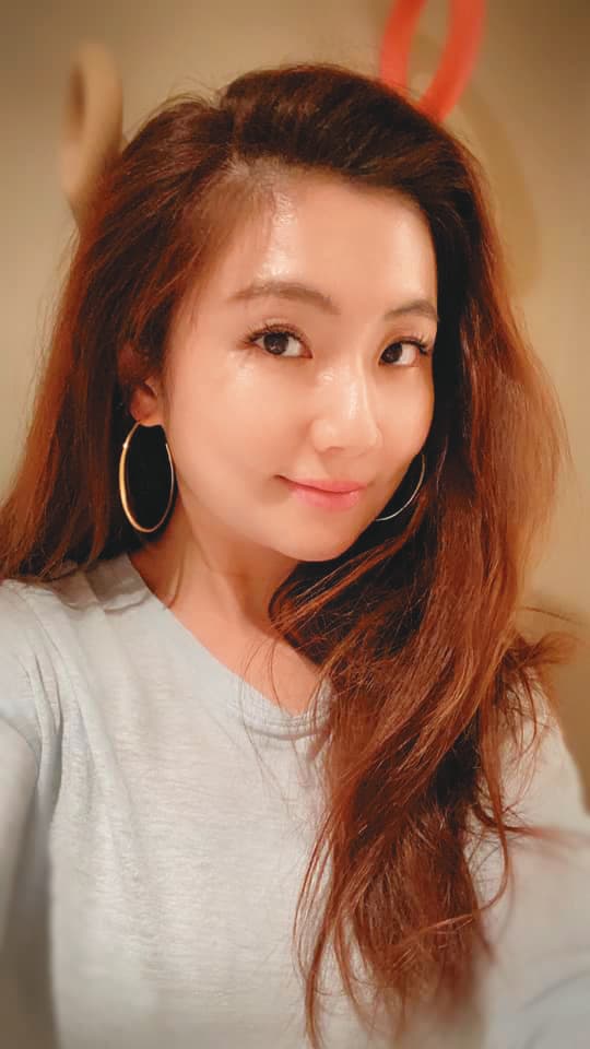 Selina拍戲遇爆炸，全身54％面積燒傷，幸好經過復健治療，她已恢復健康。（翻攝Seline臉書）