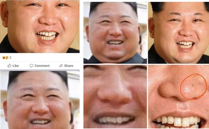 王定宇貼出對比圖，認為金正恩的牙齒形狀、臉上的痣略有不同。（翻攝自王定宇臉書）