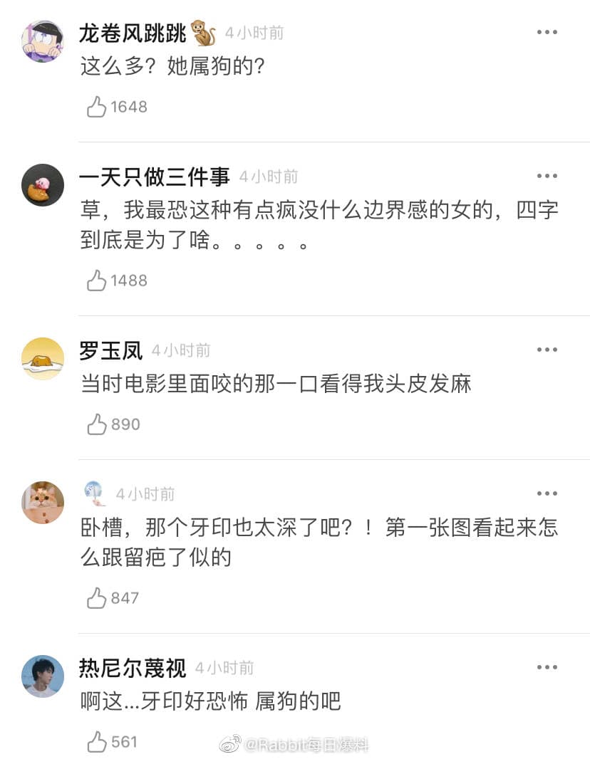 周冬雨拍《少年的你》時因劇情需要咬了同片演員的手臂，事隔一個月痕跡依舊存在。（翻攝自Rabbit每日爆料微博）