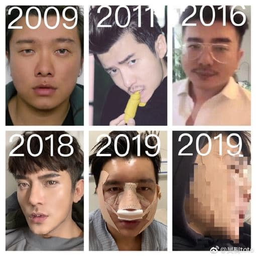 吳桐大方分享自己的換臉歷程。（翻攝吳桐微博）