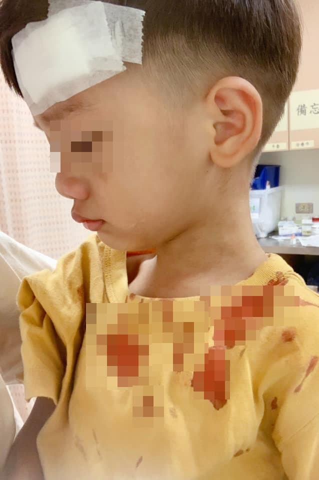 宥勝的兒子摔破頭，全身都是血。（翻攝自宥勝臉書）
