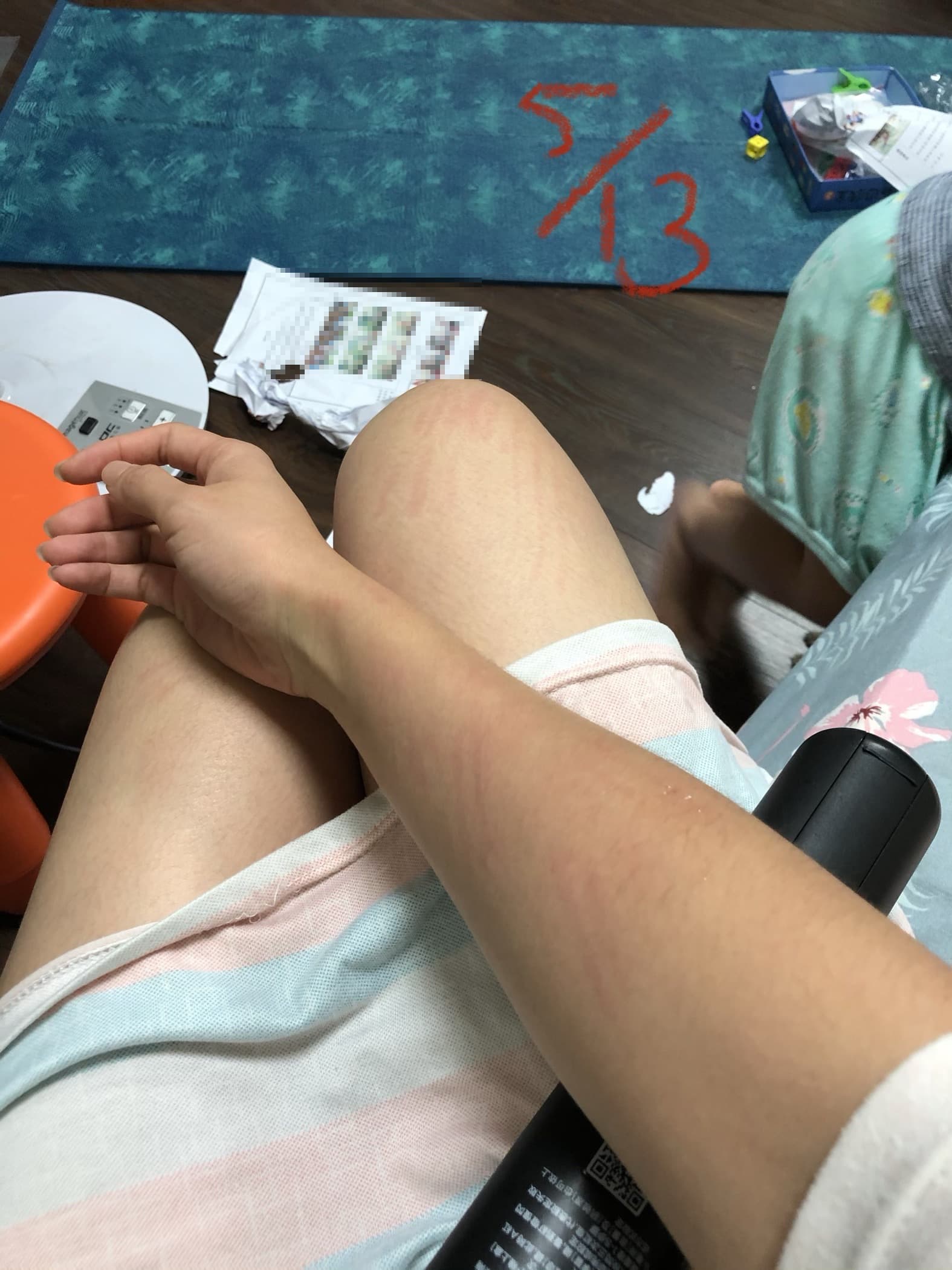 兒子失控抓咬A小姐，還說老師在學校都是這樣對待他。（讀者提供）