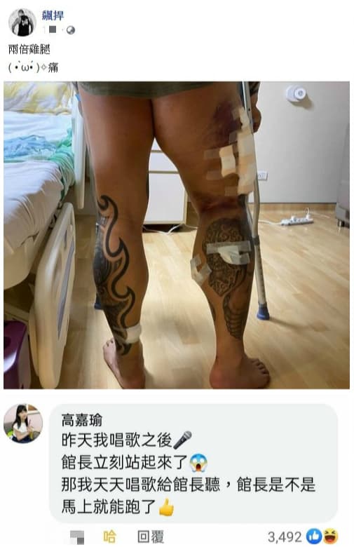 館長秀出「打斷手骨顛倒勇」再站起來的照片，曾獻唱探望的立委高嘉瑜留言：「那我天天唱歌給館長聽。」（翻攝自飆捍臉書）