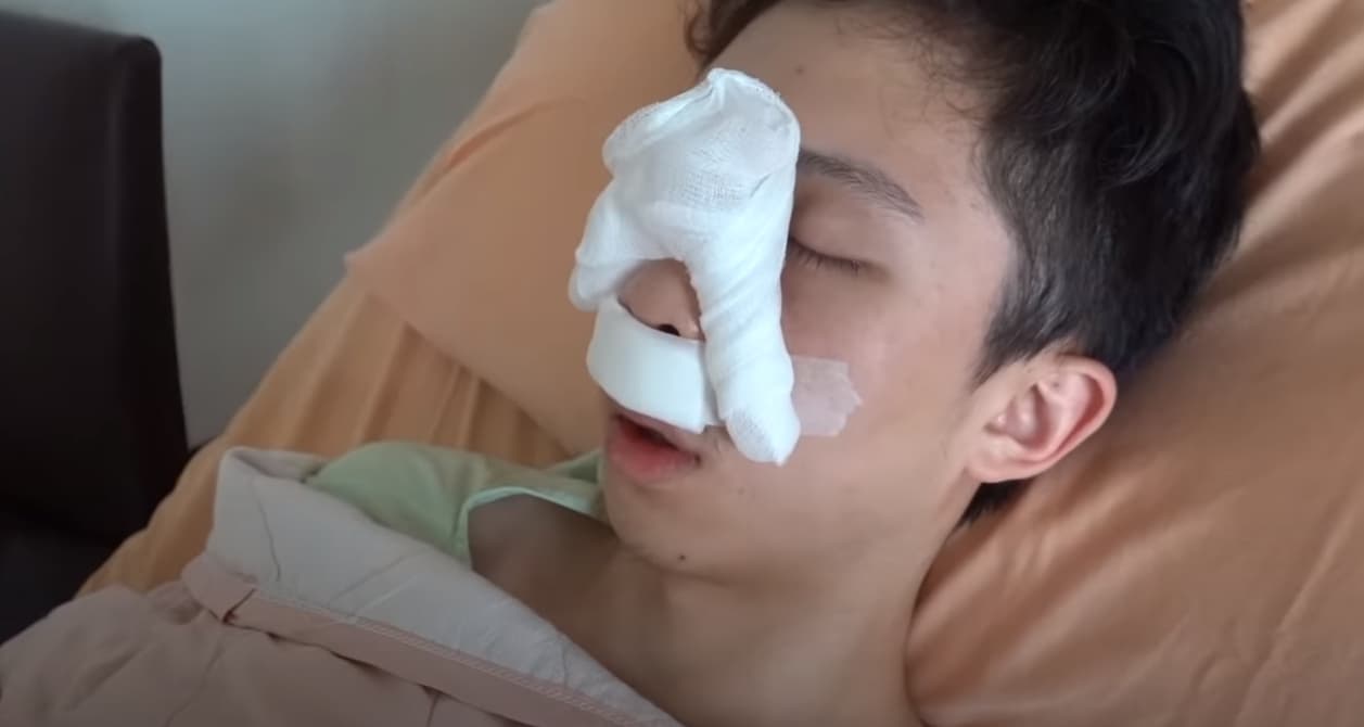 孫安佐日前接受鼻中膈彎曲手術，解決多年來的呼吸問題。（翻攝自YouTube／Sun 孫安佐的頻道 Edward）
