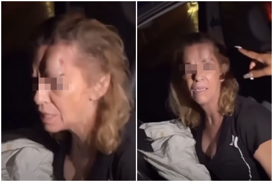 女駕駛額頭腫的像第2顆屁股，網友們看完除了驚訝之外多的是爆笑。（翻攝自 B.C.&Lowy YouTube頻道）
