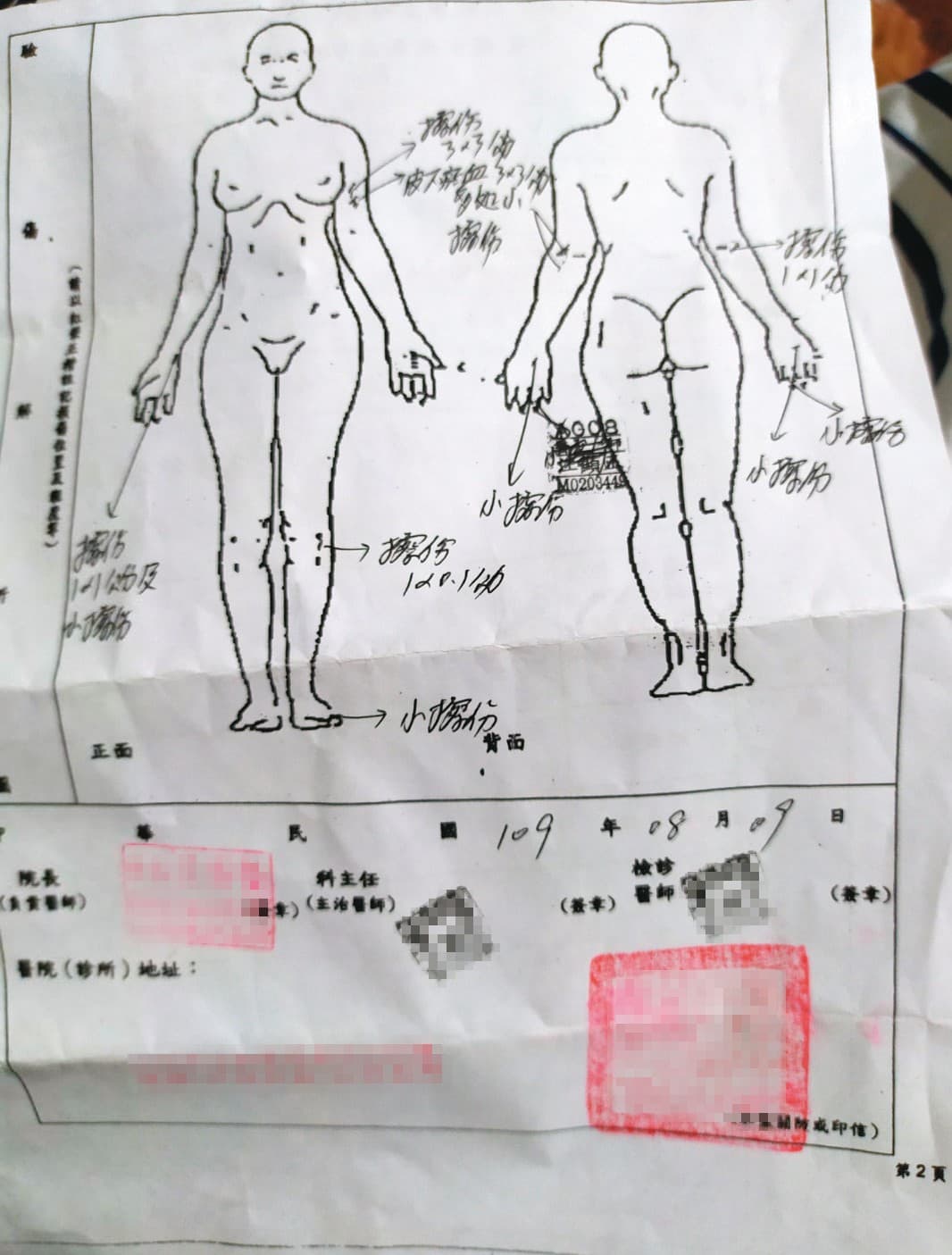 被害人H小姐事後赴醫院驗傷，並對男友提出傷害告訴。（讀者提供）