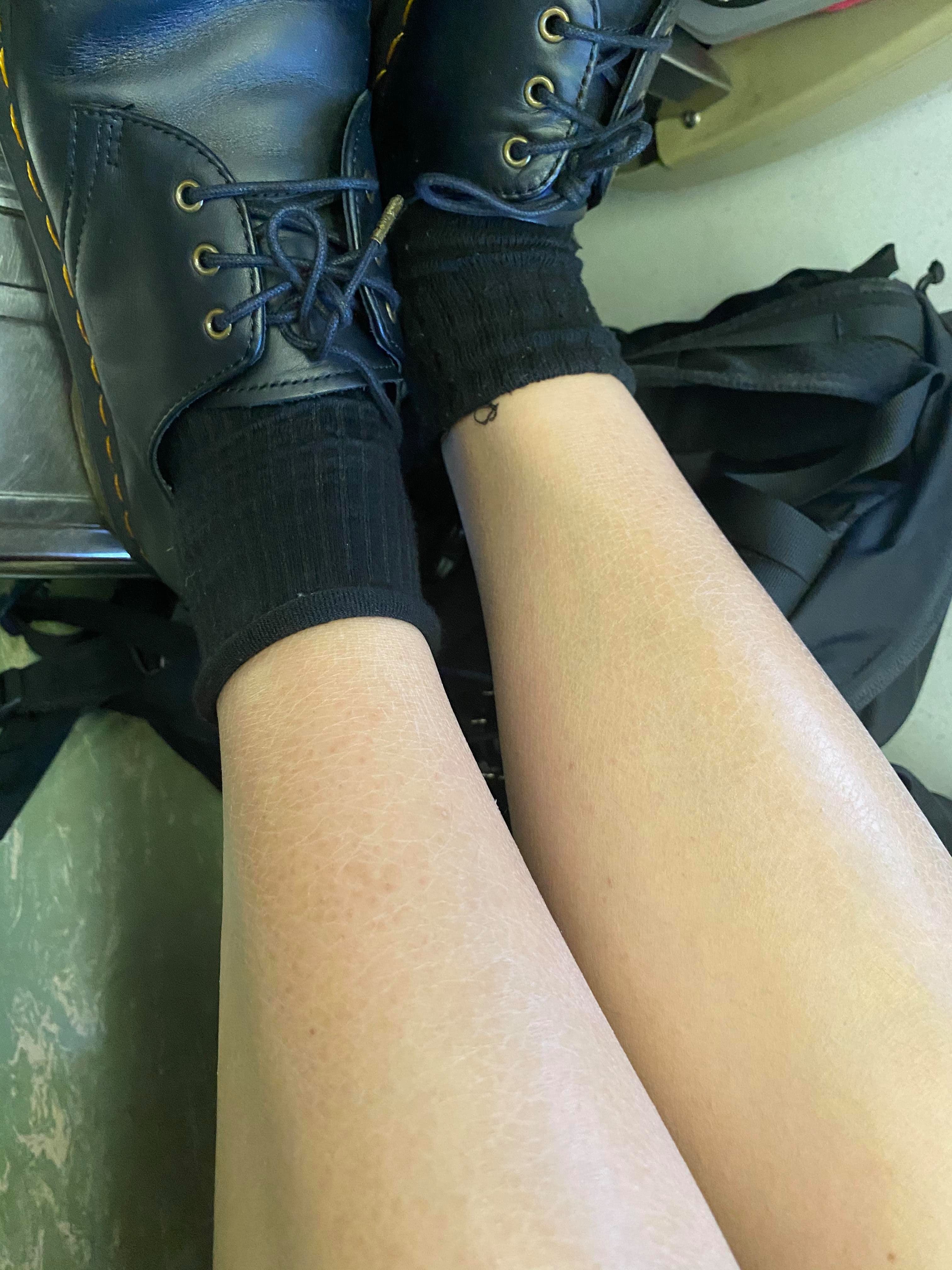 女網友表示，因長期便祕讓皮膚變得非常乾燥，即使前一天剛擦完乳液，隔天皮膚還是很乾。（當事人授權）