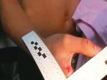 C姓少年持刀殺害丁女時，因用力過猛，自己手上也留下刀傷。（翻攝東森新聞）