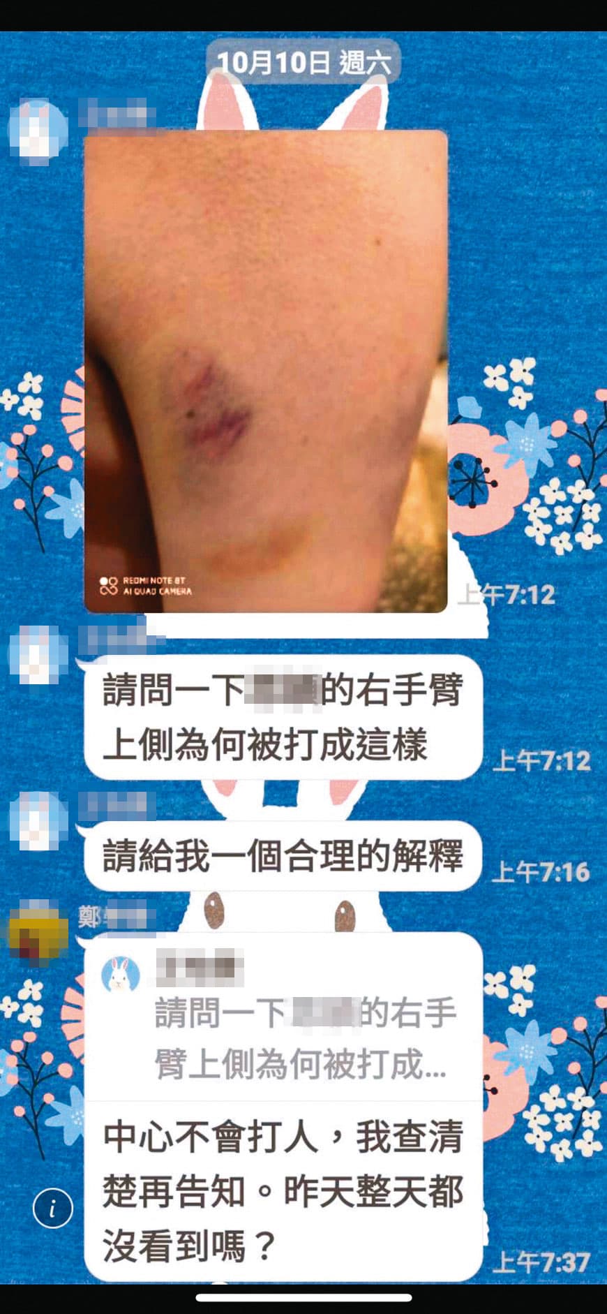 不只有小方身上出現不明瘀青，其他家長也曾在護理之家LINE群組反映類似情況，當時鄭姓主任強調中心不會打人。（讀者提供）