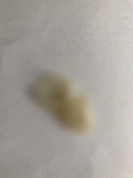 女網友表示，曾聽過保險套滑落在陰道內，但沒見過整個斷掉的情形。（翻攝自Dcard）
