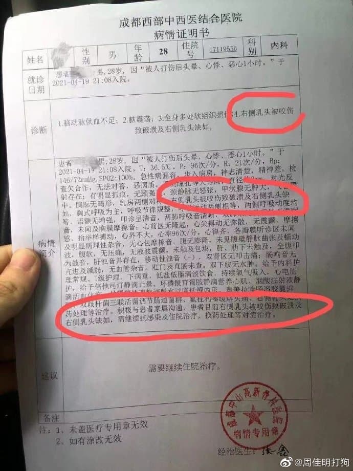 網友貼出健身教練的驗傷單，指魏雷打輸就動嘴咬人。（翻攝自微博）