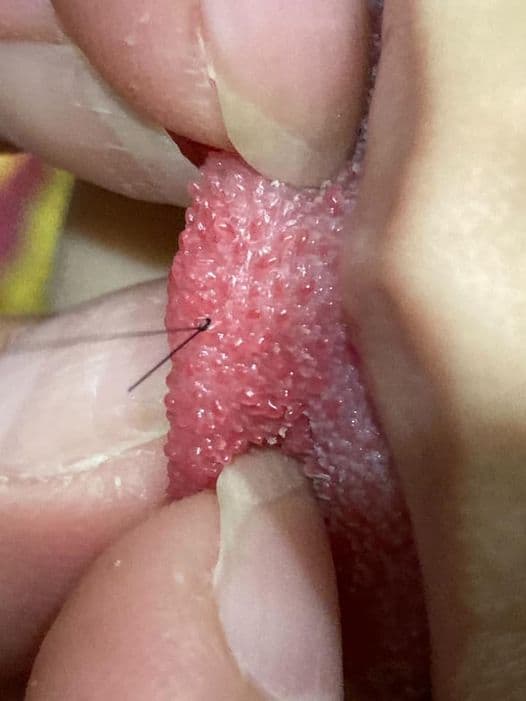 原PO發現小姪女舌頭上竟纏繞著頭髮,網友們紛紛要原PO趕緊將小姪女送醫。(翻攝自臉書社團「爆廢公社二館」)