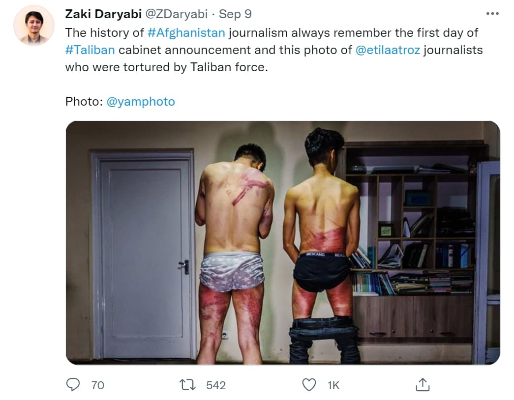 報導阿富汗女性的外國媒體記者遭到塔利班軍人的鞭打，全身是傷。（翻攝自推特 @ZDaryabi）