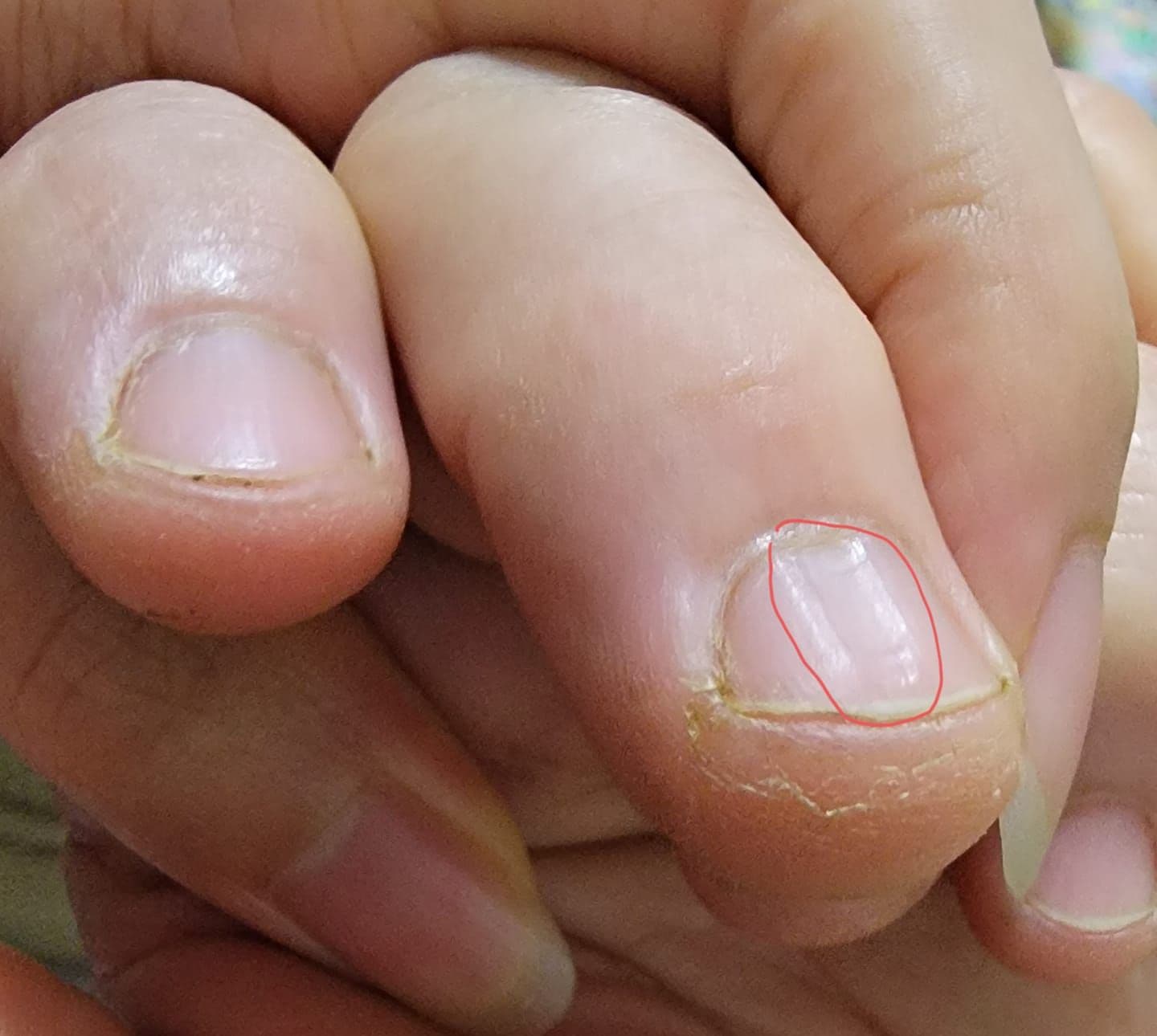 女網友貼出指甲照片，吸引過來人留言示警。（翻攝爆系知識家）