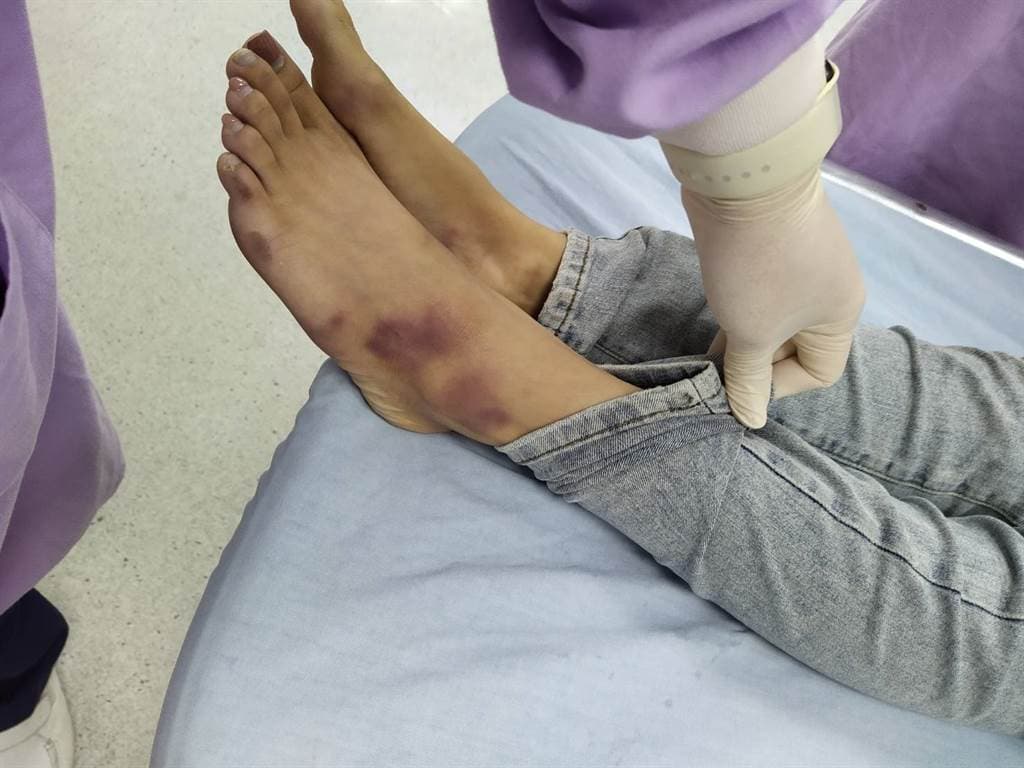 與陳修將一同入住摩鐵多日的22歲胡姓女子全身多處傷痕累累，送到彰化醫院前即已沒有生命跡象，搶救後仍宣告不治。（翻攝畫面）