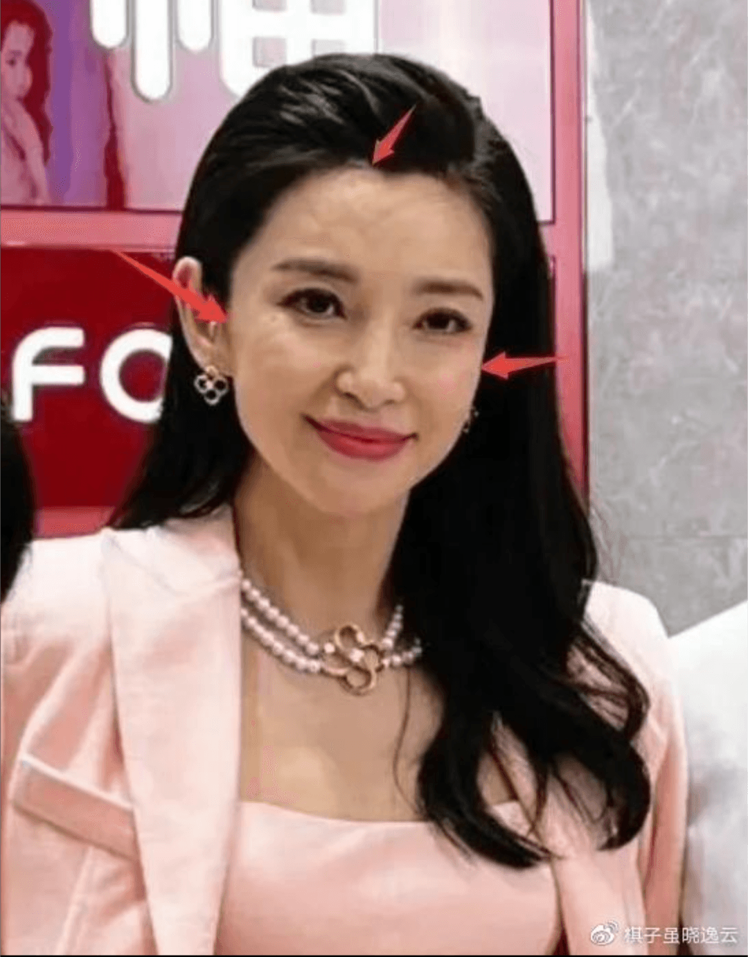 未修生圖裡李冰冰的臉卻是凹凸不平，笑容也僵硬，被懷疑打了醫美產品。（微博圖片）