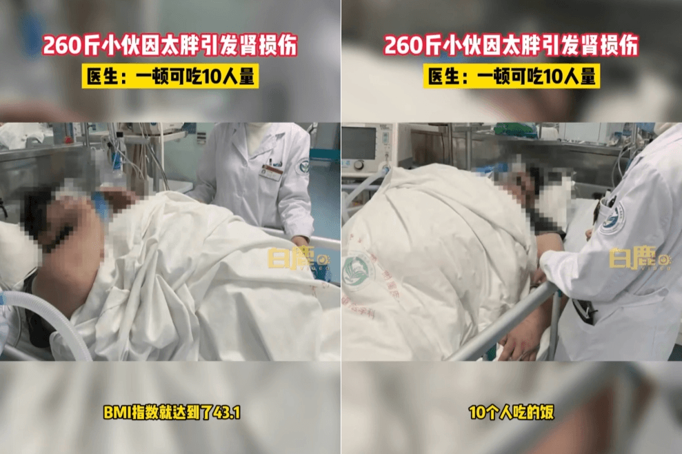 中國有一名男子一天只吃一餐，一餐卻高達10人份，引發肥胖相關疾病。（翻攝自微博）