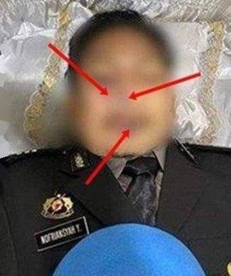 胡塔巴特臉上有多處瘀青，不只有槍傷，生前疑遭凌虐。（翻自portalyogya.com）