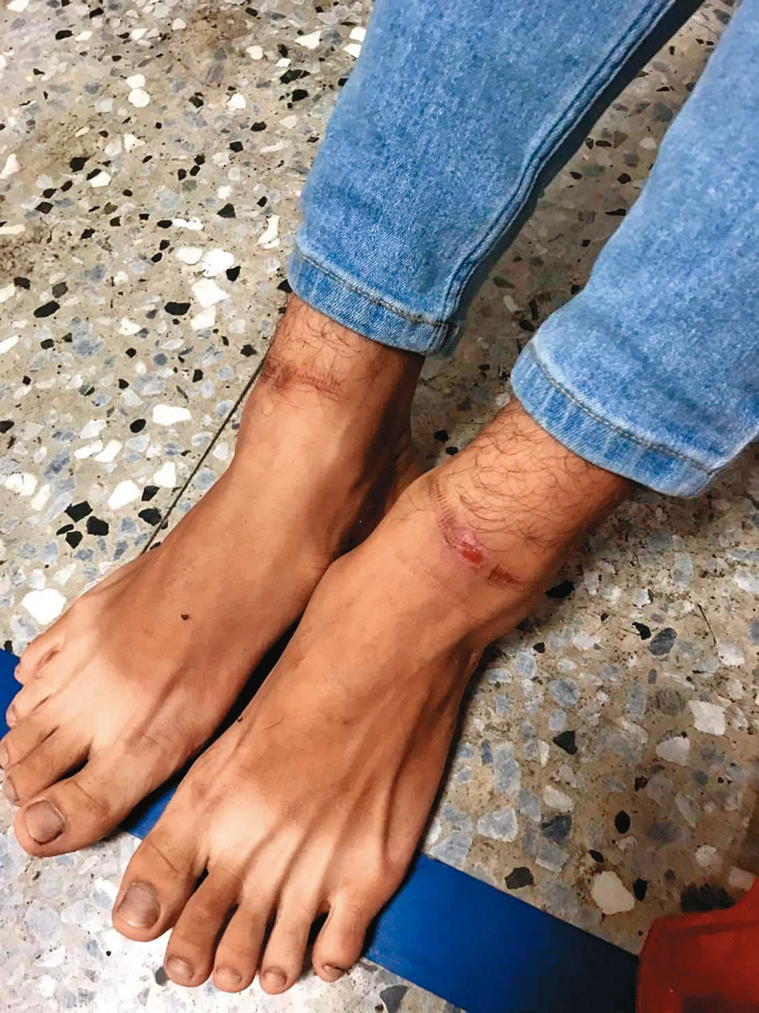 肉票被救出時滿身傷痕，警方緊急將他送醫。（警方提供）