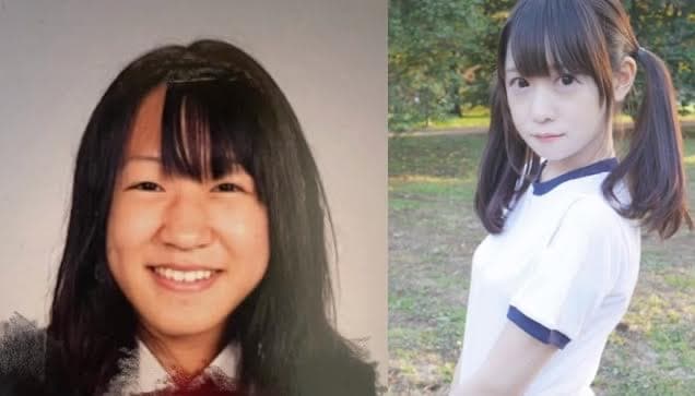 日本網紅「地雷チャン」因妹妹長得比較漂亮，砸千萬日幣整型變臉。（翻攝抖音@zirazyo_）