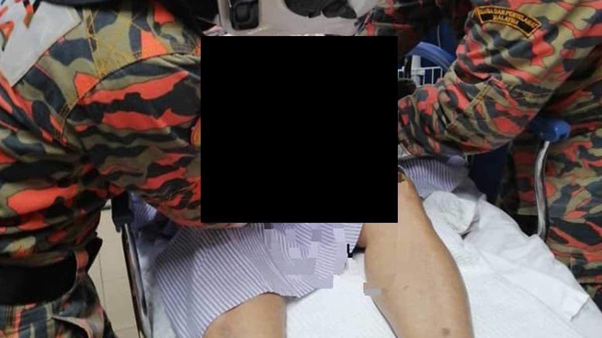 72歲馬來西亞老翁將戒指套進陰莖無法取出，靠消防隊動用大剪刀剪斷戒指協助脫困。（翻攝f4izalhassan推特）