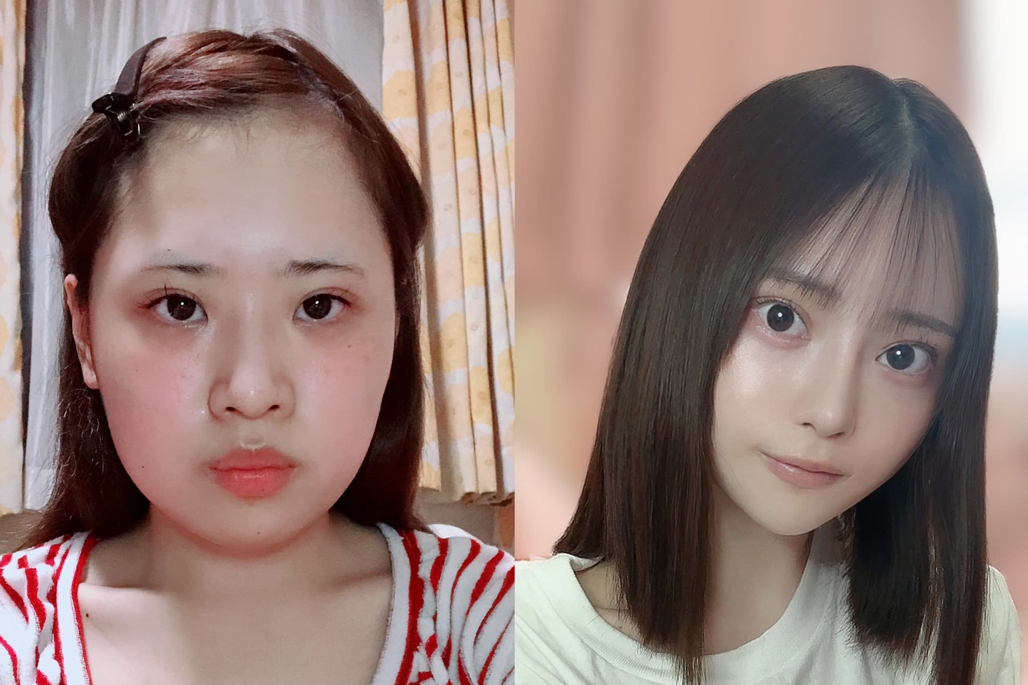 日本一名女子花費至少800萬日圓整形，成功變身成為一名正妹，手術前後照片引起網友熱議。（翻攝自@karinntter推特）