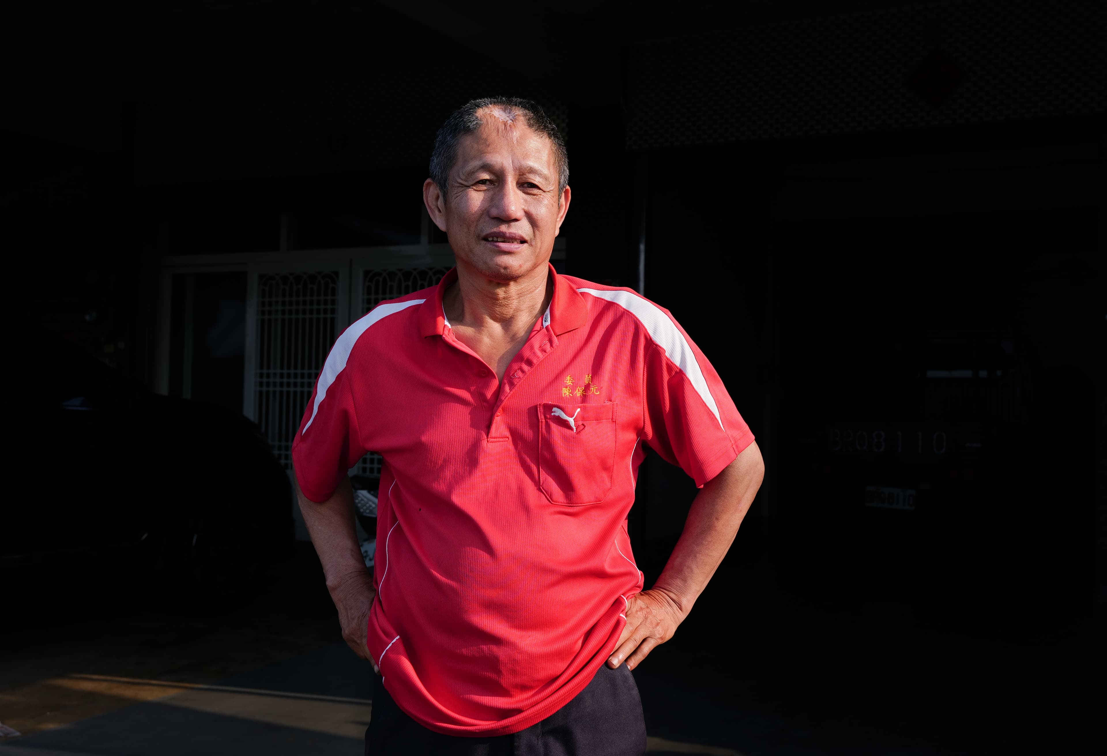 陳保元擔任乩生40年，因為操五寶敲擊，額頭上方凹陷明顯且長不出頭髮。