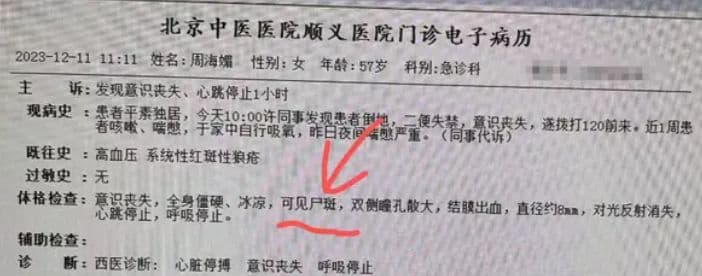 周海媚急診病例在網路流傳。（翻攝自微博）