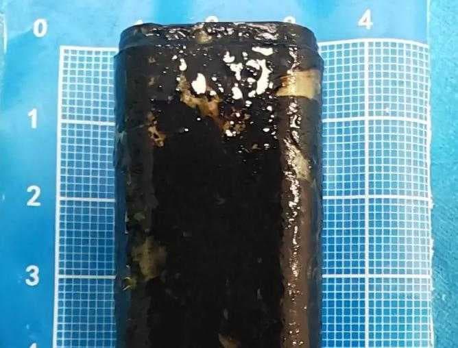醫療團隊以微創方式成功取出男子胃中滯留30年的打火機。而被胃酸腐蝕變黑的打火機仍保有結構，甚至還能正常使用。（翻攝自微博/四川觀察）