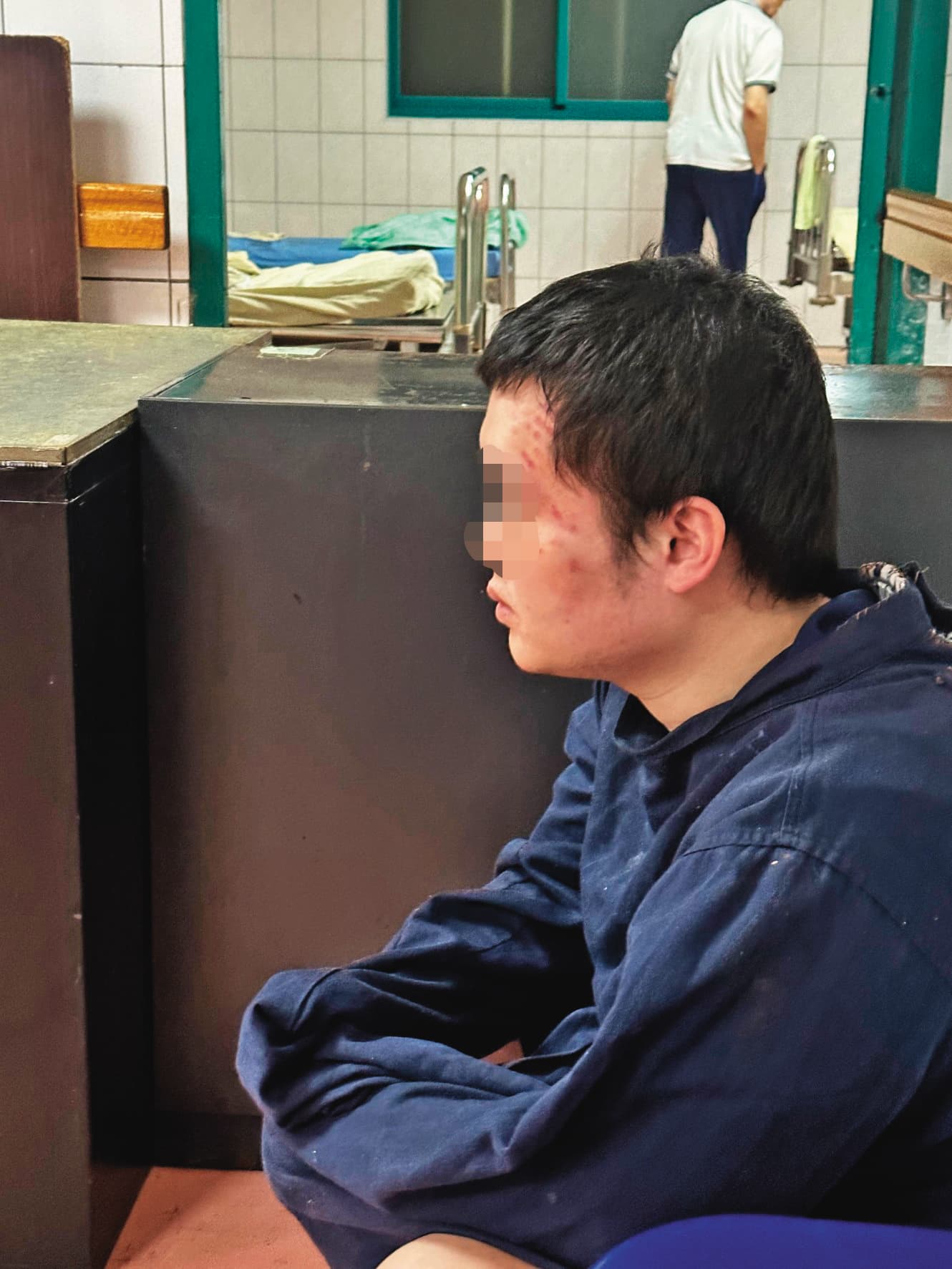 楊姓男子（圖）多處遭激烈毆打，事發多天後，臉上仍留有傷痕。（投訴人提供） 