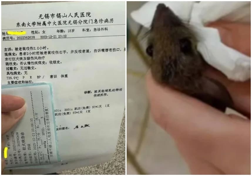 根據上圖左，女子自述咬了老鼠後嘴巴出現傷口，因此要求醫院打針治療。（翻攝自微博）