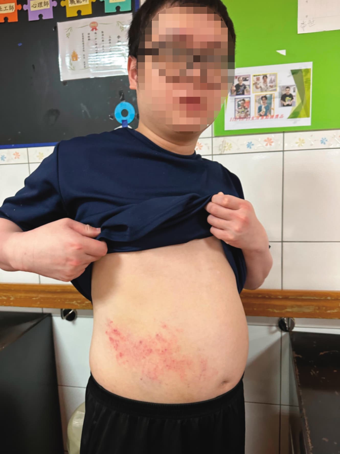 楊姓男子（圖）遭林智文拳打腳踢，腹部嚴重瘀傷。（投訴人提供）