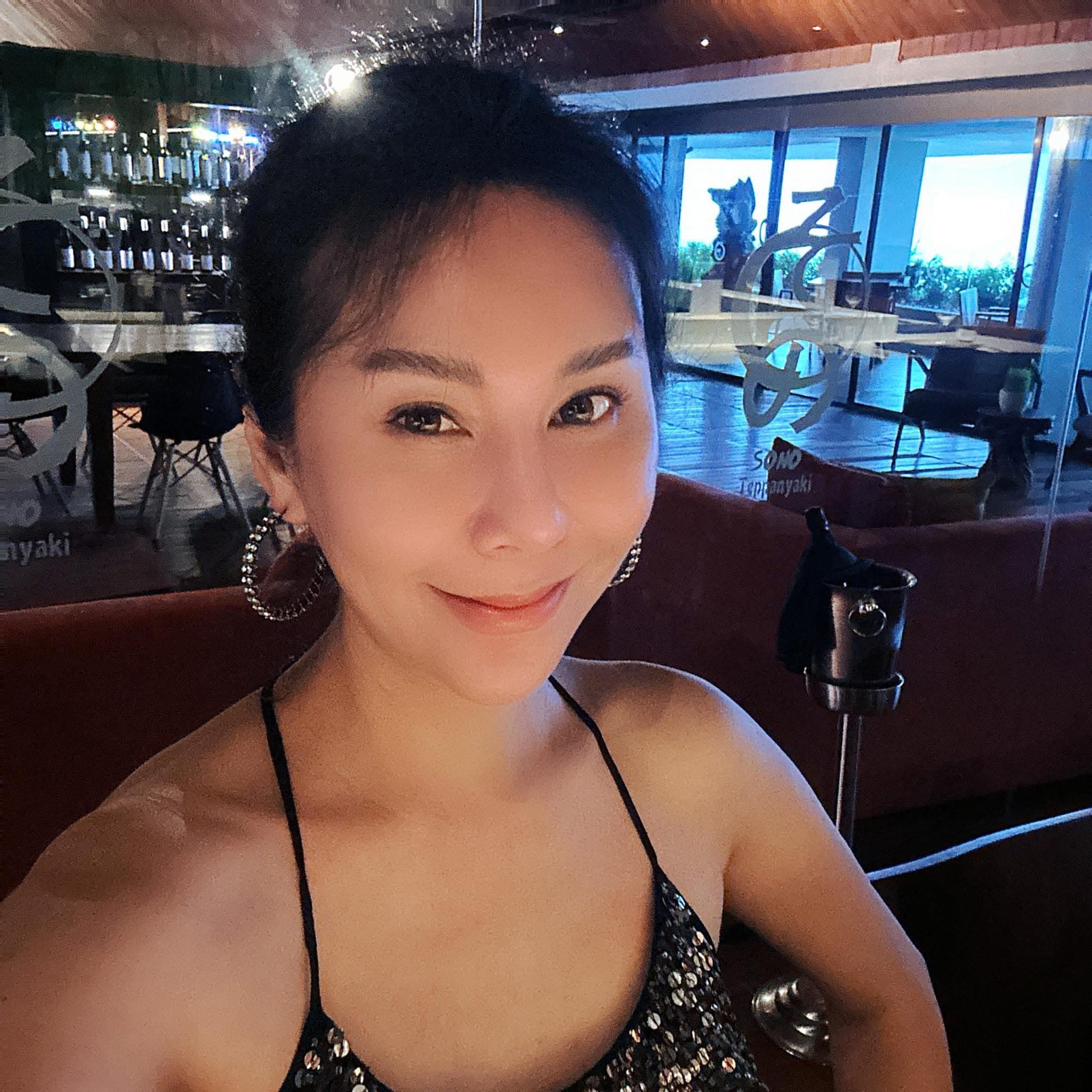 名模洪曉蕾2023年在西班牙旅遊時因感染住進加護病房手術。（翻攝自洪曉蕾臉書）