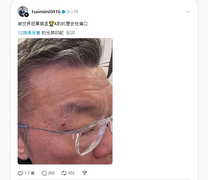 蔡其昌今分享被冠軍獎盃K到的「光榮印記」。（翻設自Threads）