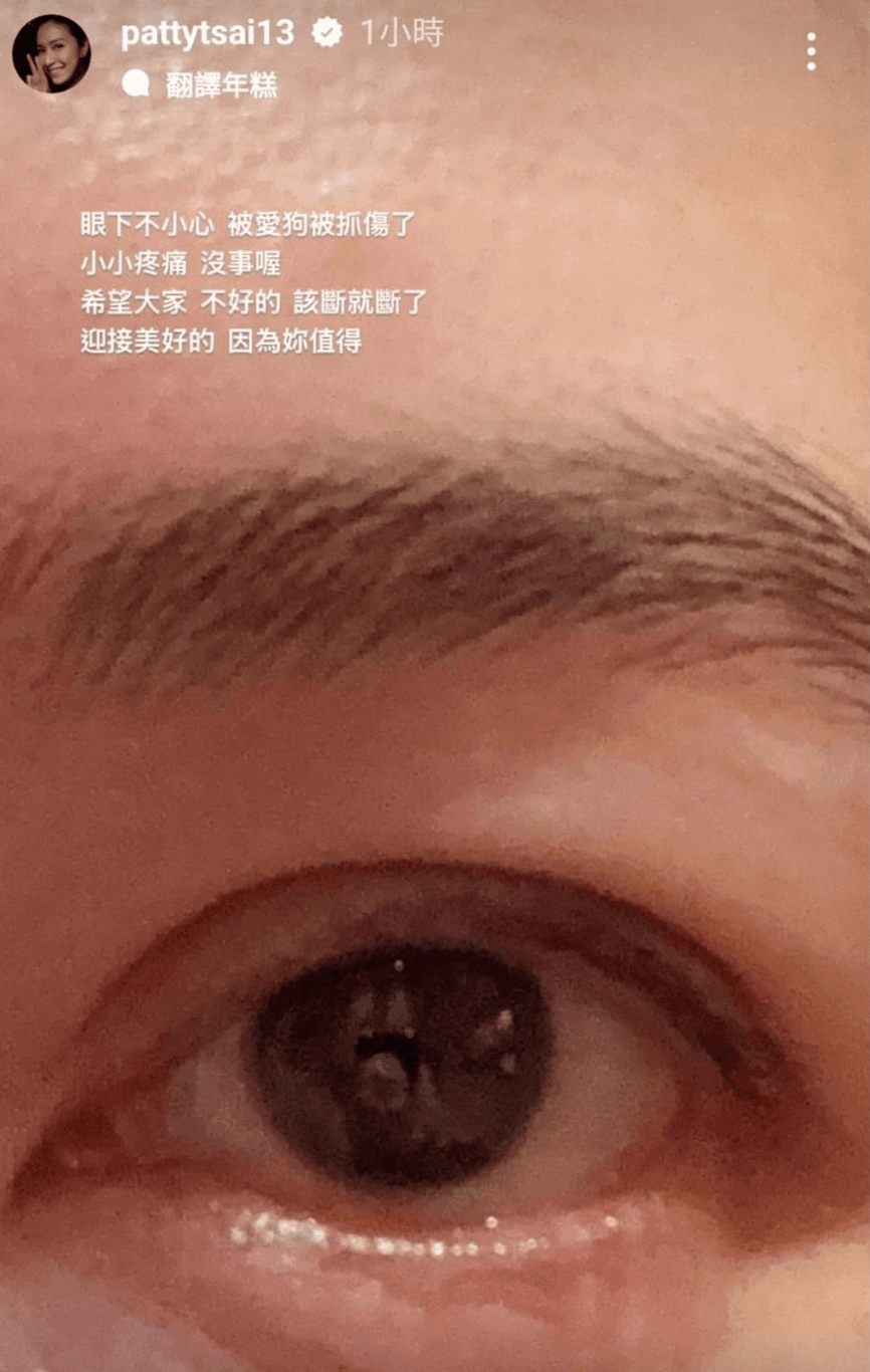 蔡依珊昨日在限動表示自己眼下被愛犬抓傷，又感嘆「該斷就斷了」，隨後刪除動態。（翻攝自IG@pattytsai13）