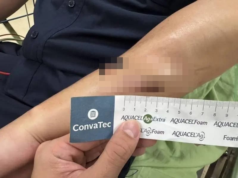 受傷員警隨後送醫縫合，所幸意識清楚並無生命危險。（翻攝畫面）