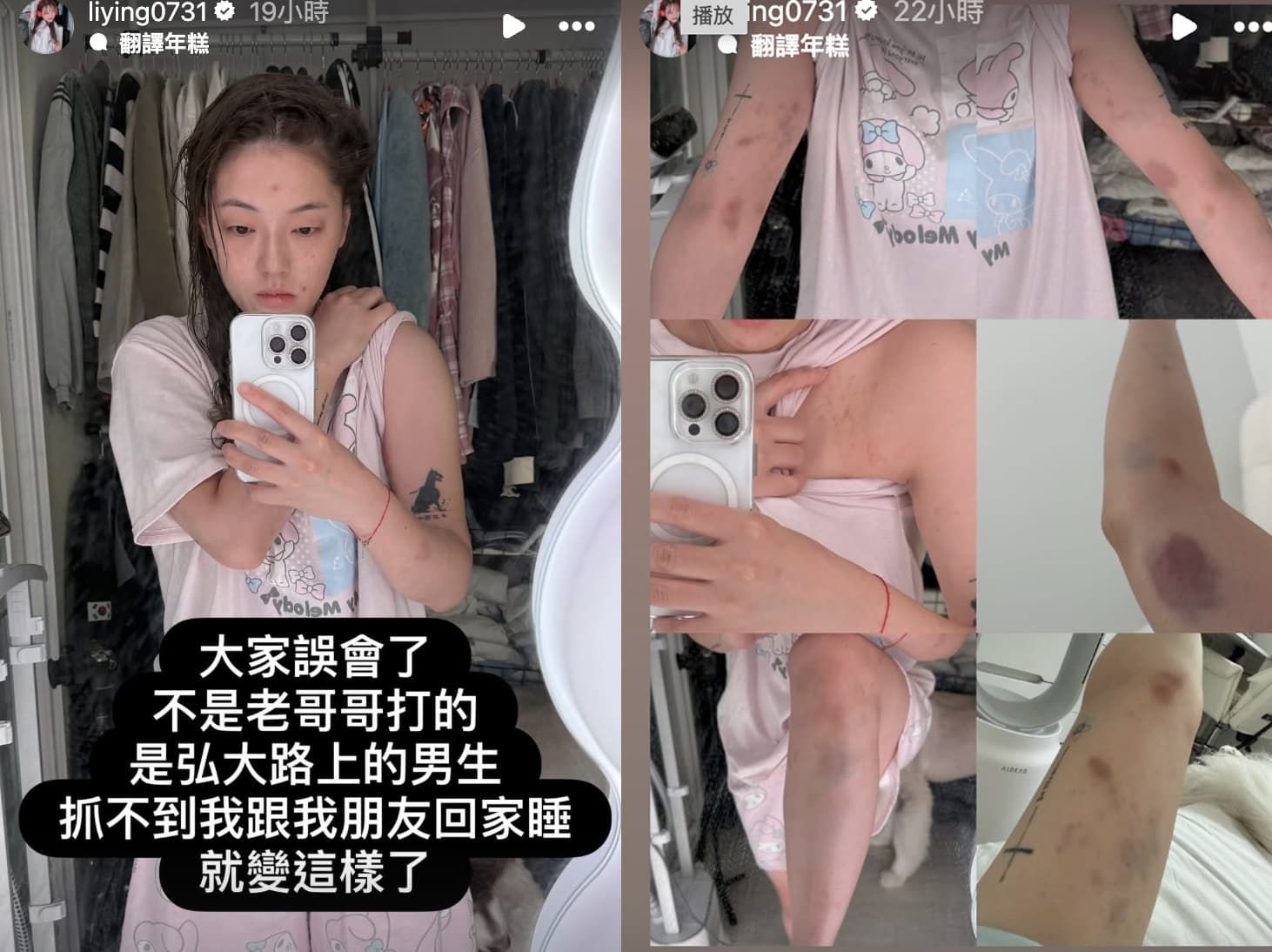 劉力穎近日在社群發文揭露自己在弘大遭暴力攻擊。（翻攝自IG＠liying0731）