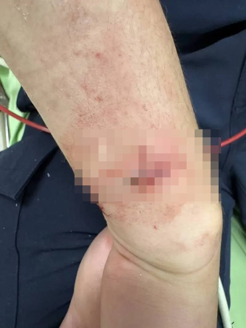 受傷員警隨後送醫縫合，所幸意識清楚並無生命危險。（翻攝畫面）
